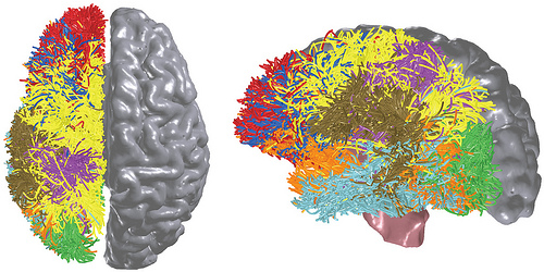 IBM research, brain