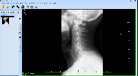 Prehliadanie medicínskeho CD 1: Prehliadač TatraMed., obrázek 3