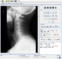 Prehliadanie medicínskeho CD 2: Prehliadač dicomscope., obrázek 2